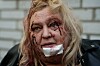 Bildet viser Olena Dniprovska som ble skadd i russiske angrep natt til tirsdag. Foto: Evgeniy Maloletka / AP / NTB