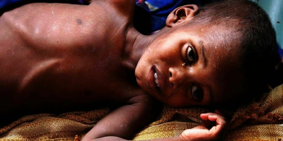 SULTER: Barn er blant dem som sliter med sult i Somalia. Denne gutten får behandling på sykehus. Verdens-organisasjonen FN sier at det er hungersnød i landet. Mange barn og voksne dør hver dag. Årsaken er mangel på mat og vann.