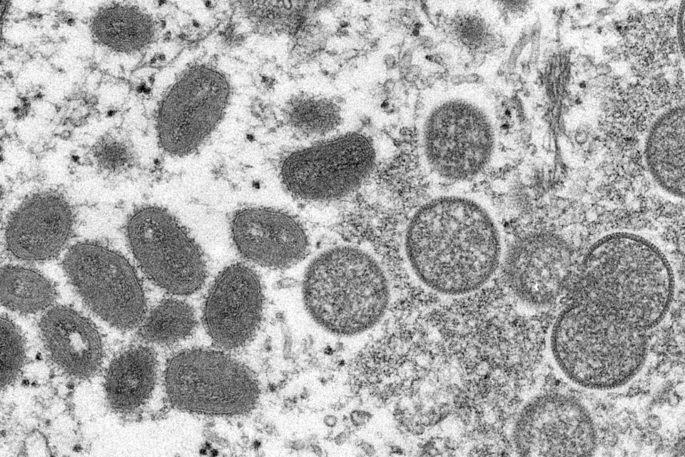 VIRUS: Det er funnet smitte med apekopp-virus hos mer enn 15.000 personer i verden siden første del av mai. Bildet er av apekopper-virus under et mikroskop. Foto: Cynthia S. Goldsmith, Russell Regner / CDC / AP / NTB