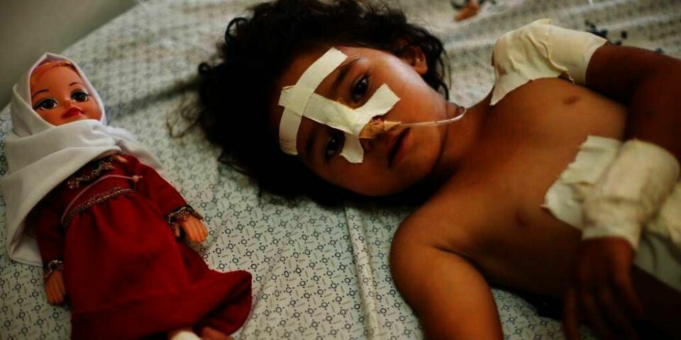 SKADD:  Fire år gamle Shayma Al-Masri ble skadd i et lutftangrep på Gazastripen mandag. Hun og faren var de eneste som overlevde angrepet i familien. Både moren og to andre slektninger ble drept.