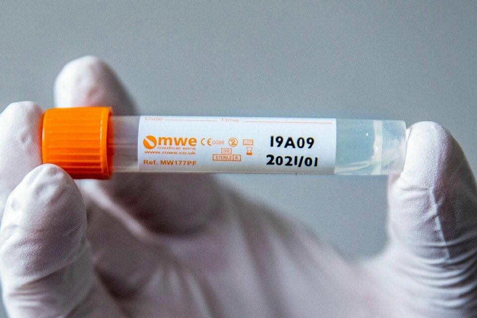 TEST: En test viser om folk er smittet av korona-virus eller ikke.