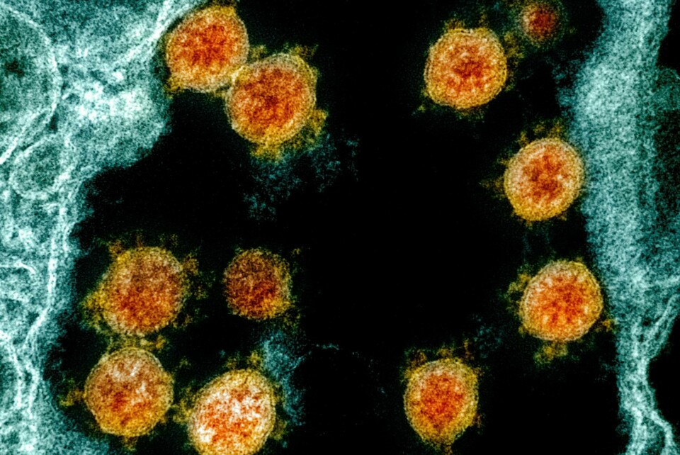 VIRUS: En medisin viser seg å hjelpe korona-pasienter med puste-vansker. Færre dør med denne medisinen.