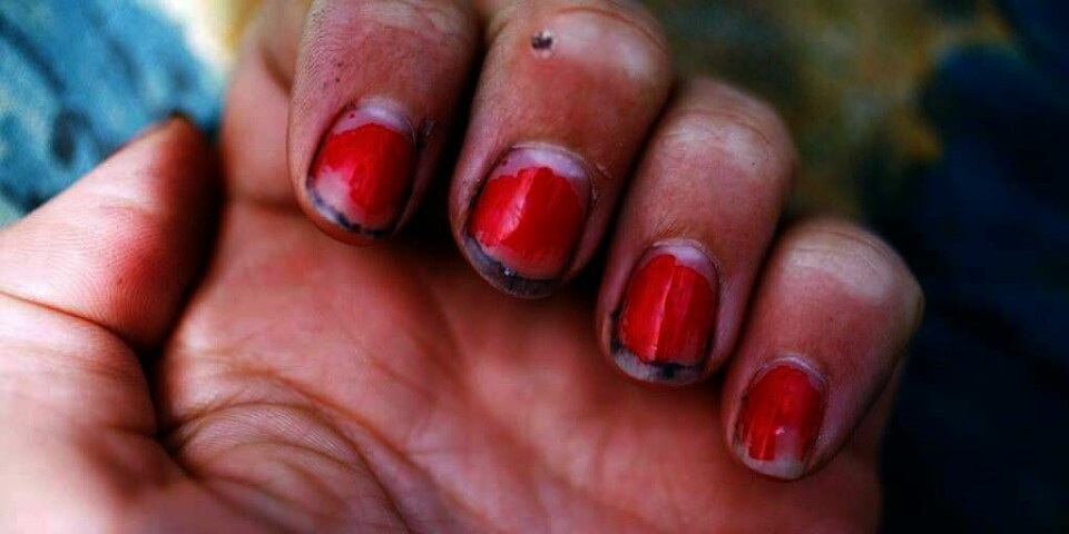 HÅNDHYGIENE:  Vask skitne hender om du vil unngå omgangsyken. Nå er sesongen for norovirus i gang.