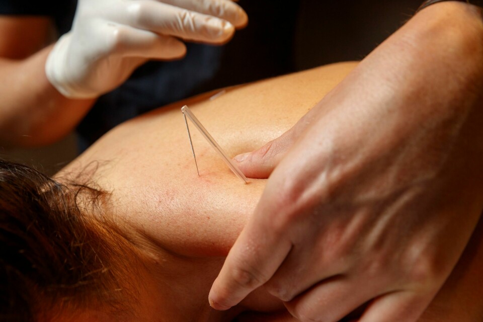 NÅLER: Akupunkt stikker tynne nåler inn i huden. Noen mener behandlingen virker, andre ikke. Fire personer i Rogaland har hittil i år havnet på sykehus etter å ha fått punktert lungen under akupunkturbehandling. Fylkeslegen skal nå undersøke tilfellene.Foto: Cornelius Poppe / NTB