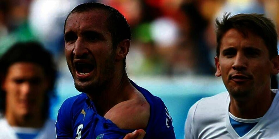 BITT: Italienske Giorgio Chiellini viser fram bitemerket i skulderen.