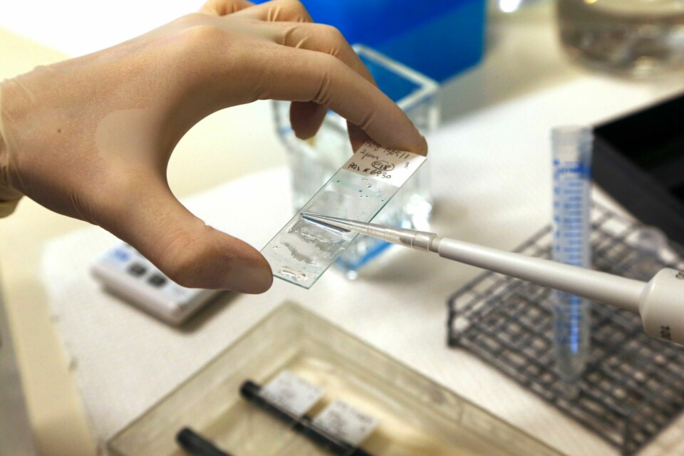 KREFT: Færre nordmenn fikk påvist kreft i 2023 enn i 2022. Bildet viser hendene til en lege som gjør klar en kreftprøve. Foto: Lise Åserud / NTB