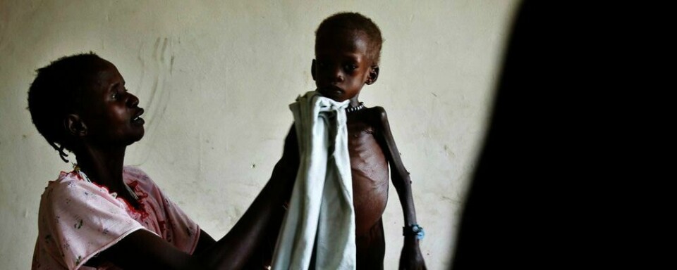 SULT: To år gamle Dhoah Thoan er påsykehus sør i Sudan. Han har ikke fått nok mat. Landet sliter meddårlige avlinger, sult, sykdom og folk som flykter fra krig. Det er bare én av de glemte katastrofene i verden.