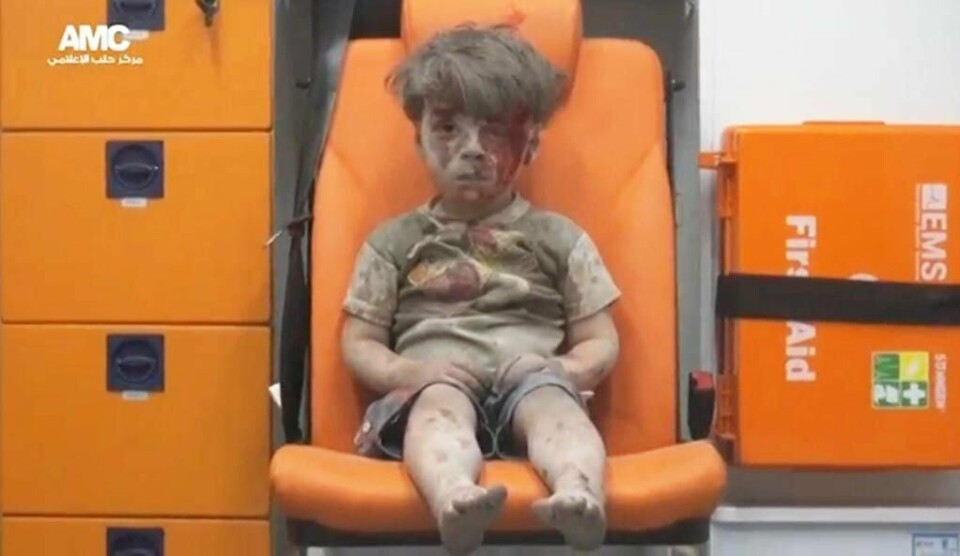 SKADD: Omran ble skadd i et bombeangrep i Syria. Femåringen ble hentet fram fra ruinene.