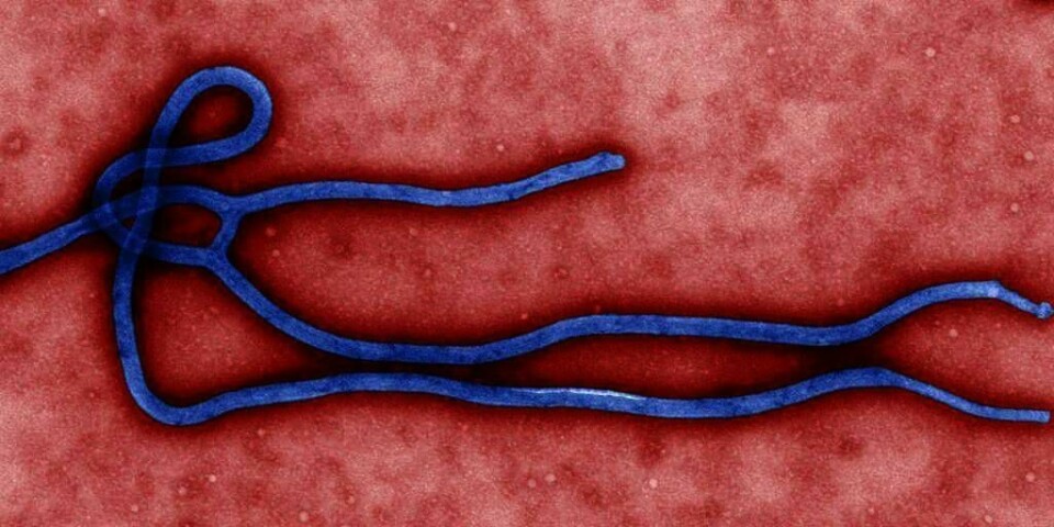 VIRUS: Slik ser ebola-viruset ut. Nå er en mann i USA blitt syk av viruset. Han er den første som har blitt syk i USA. Over 3.000 mennesker er til nå døde av sykdommen i Vest-Afrika.